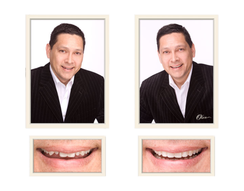 Orsatti Dental in San Antonio - Gallery & Smile Testimonials