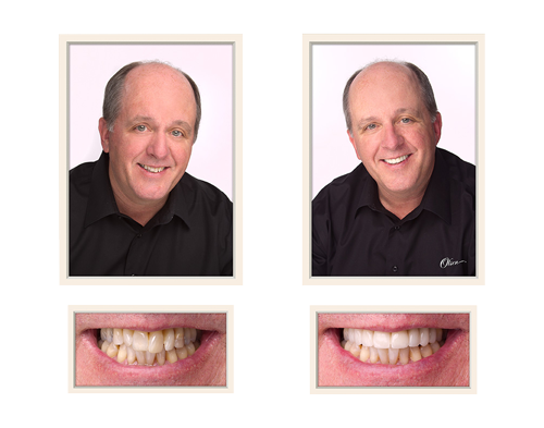 Orsatti Dental in San Antonio - Gallery & Smile Testimonials