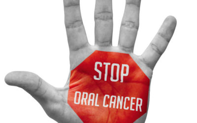 Oral Cancer Awareness – Orsatti Dental in San Antonio