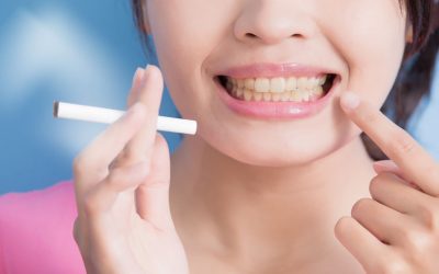 Tobacco and Oral Health – Orsatti San Antonio Dentist