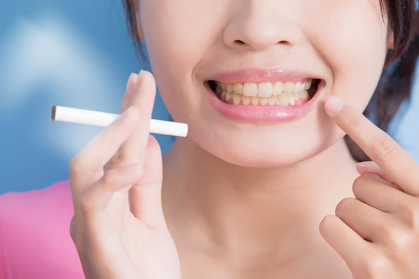 Tobacco and Oral Health – Orsatti San Antonio Dentist