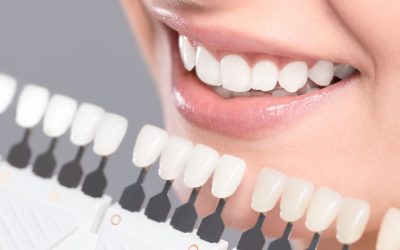 Dental Implants – Orsatti Dental San Antonio